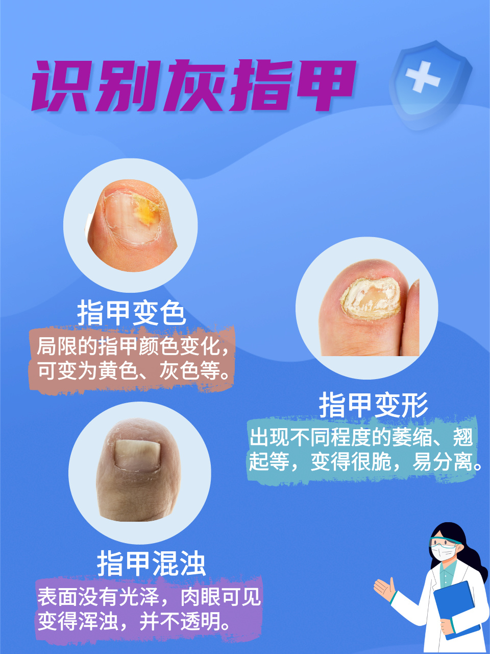 一分钟识别灰指甲,快快码下来!