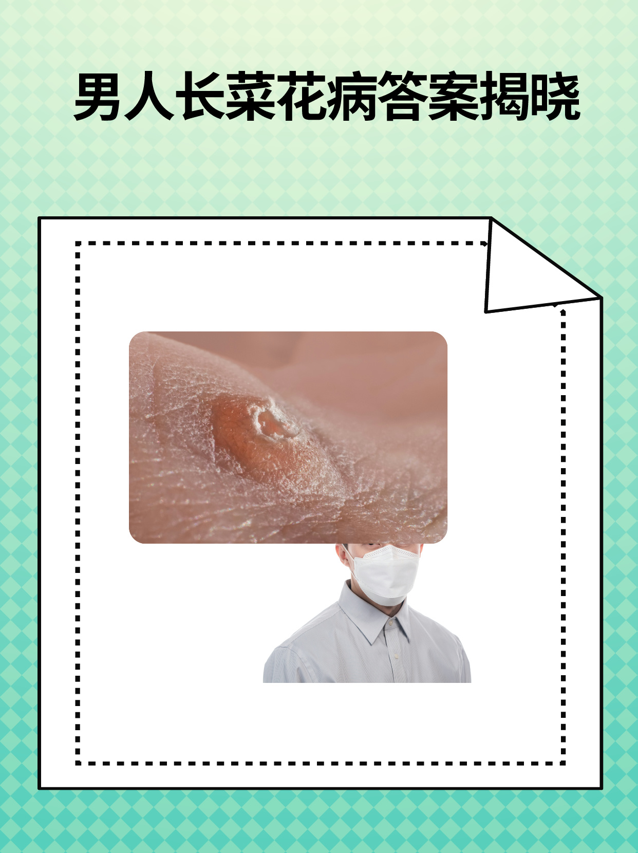 男人长菜花病答案揭晓