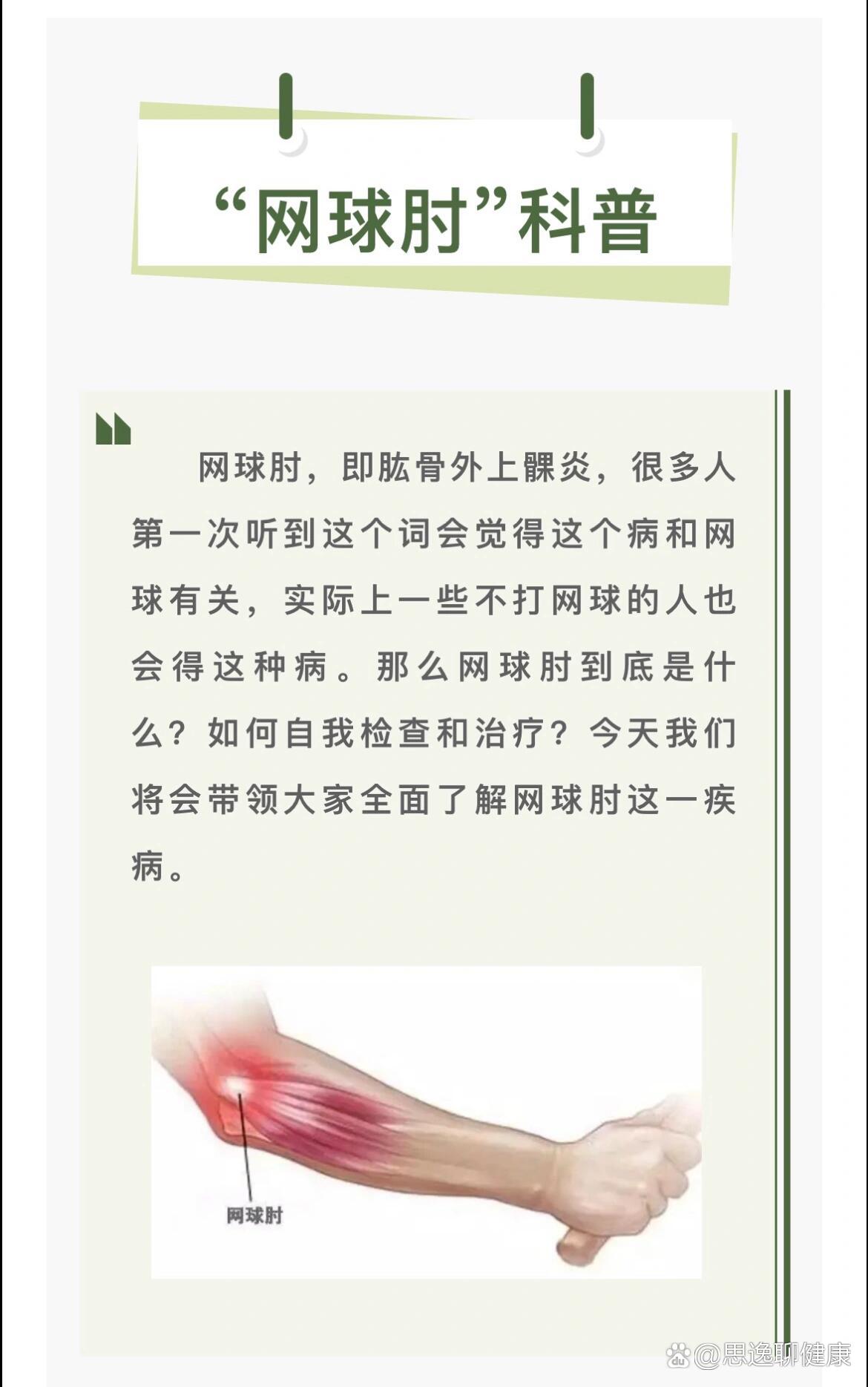 网球肘即肱骨外上髁炎,你了解吗?