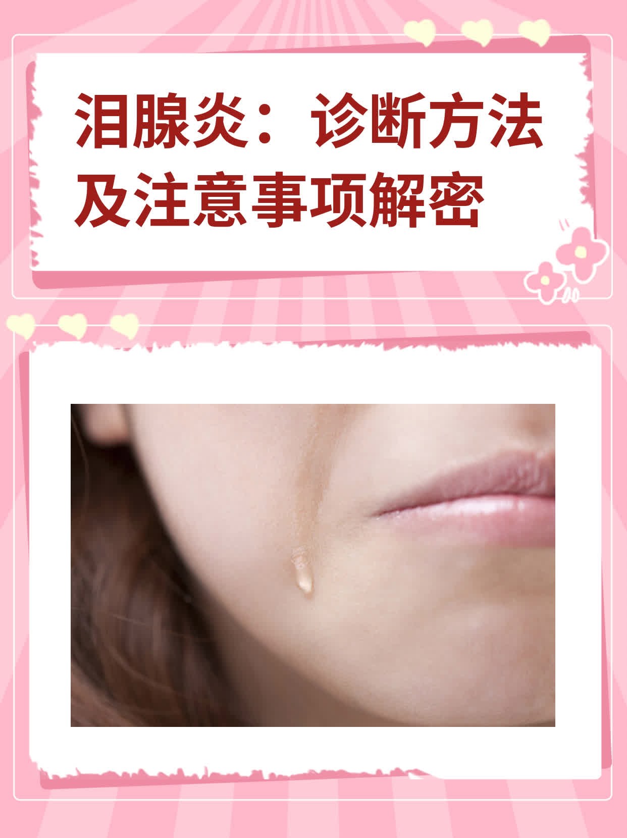 泪腺炎:诊断方法及注意事项解密