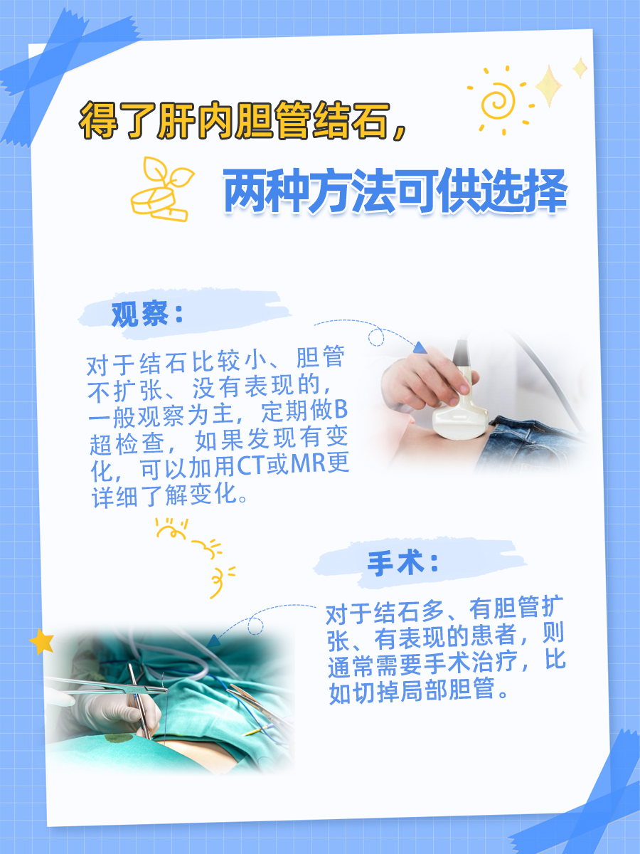 肝内胆管结石危害大,教你如何应对!