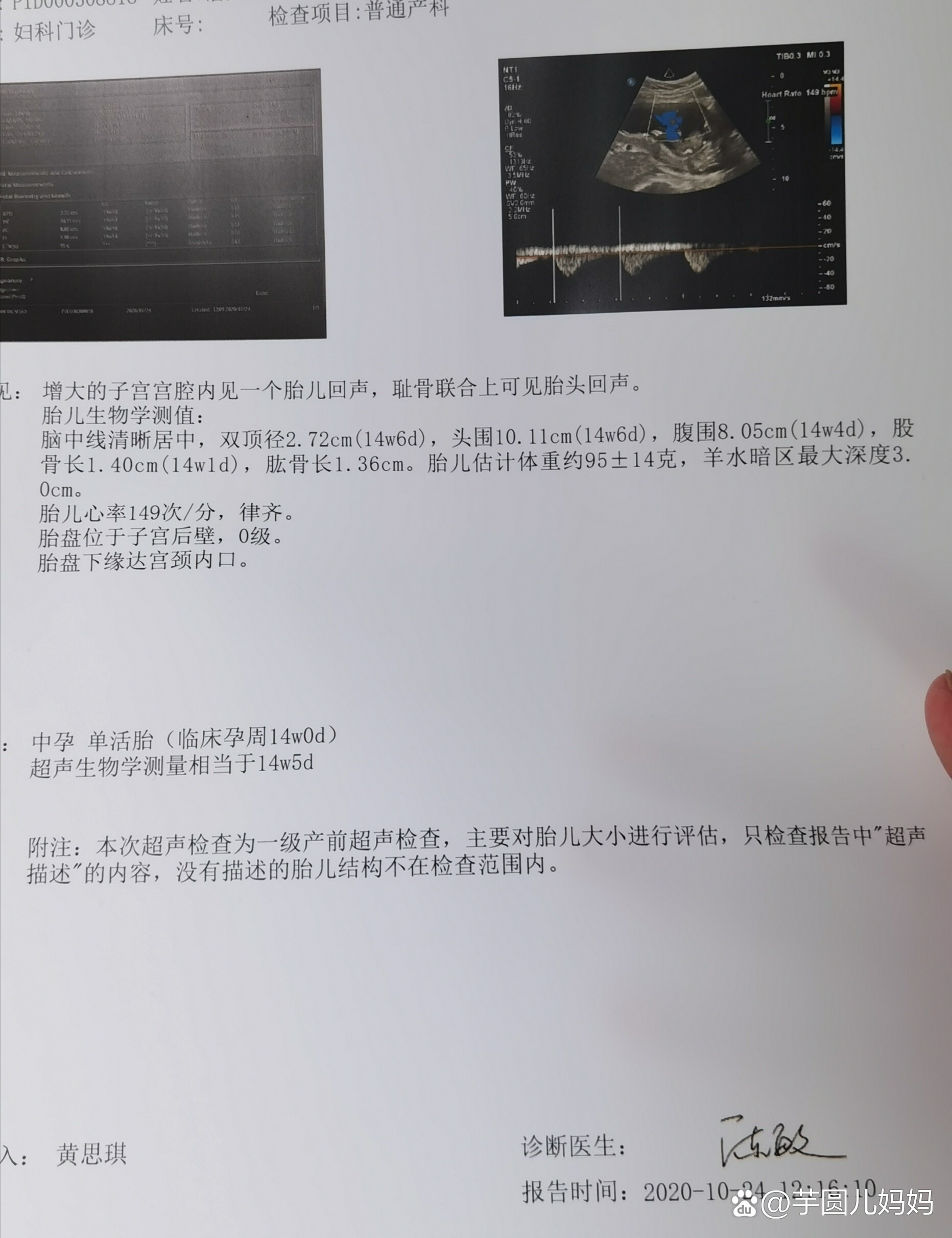 三代试管怀孕14周胎停