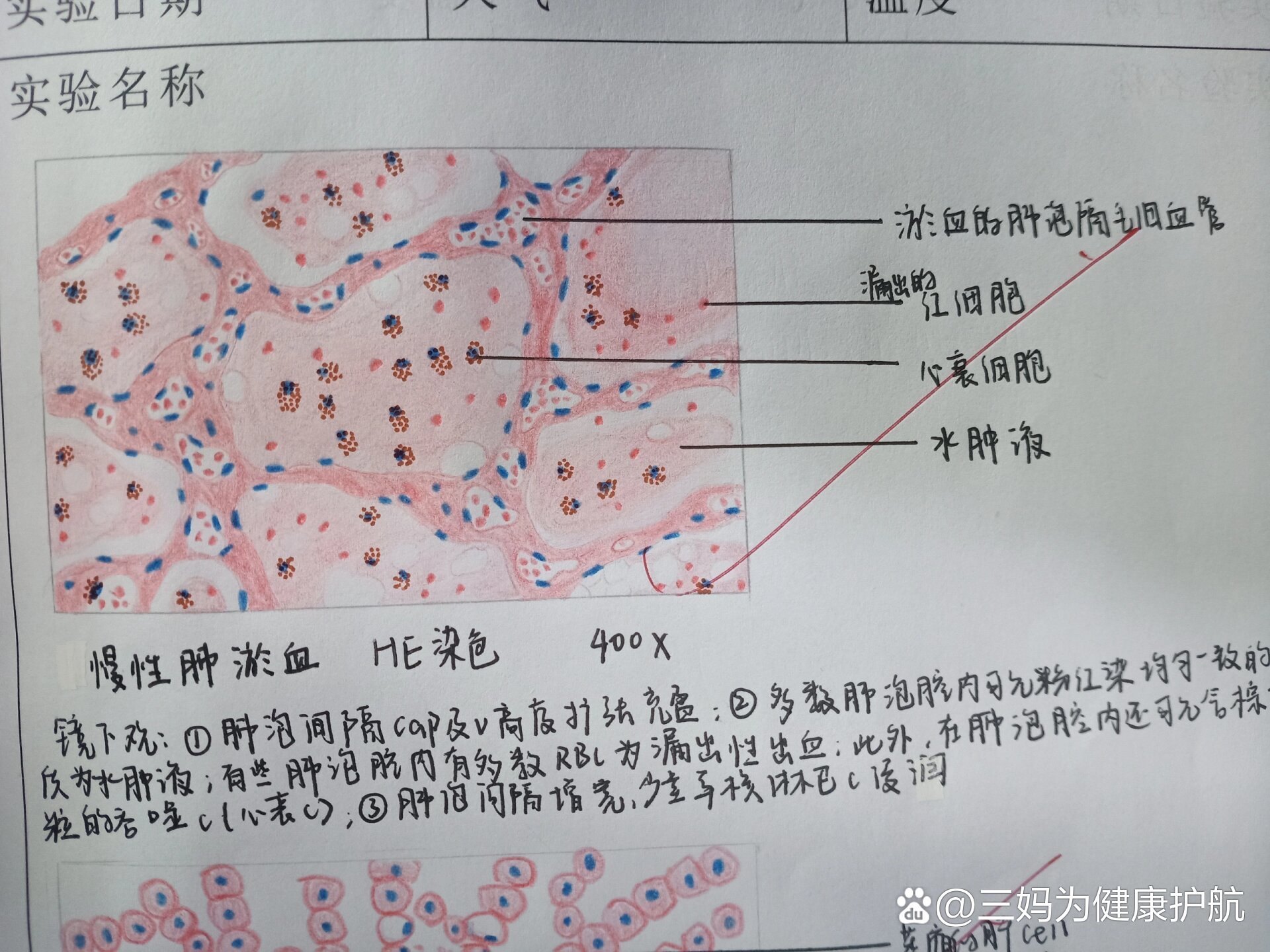 结核结节实验报告图片