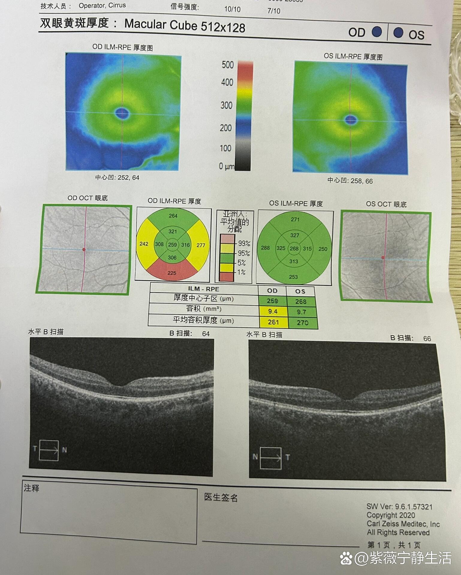 p 有医生朋友可以帮忙看看吗 br 高度近视去医院查了下眼底