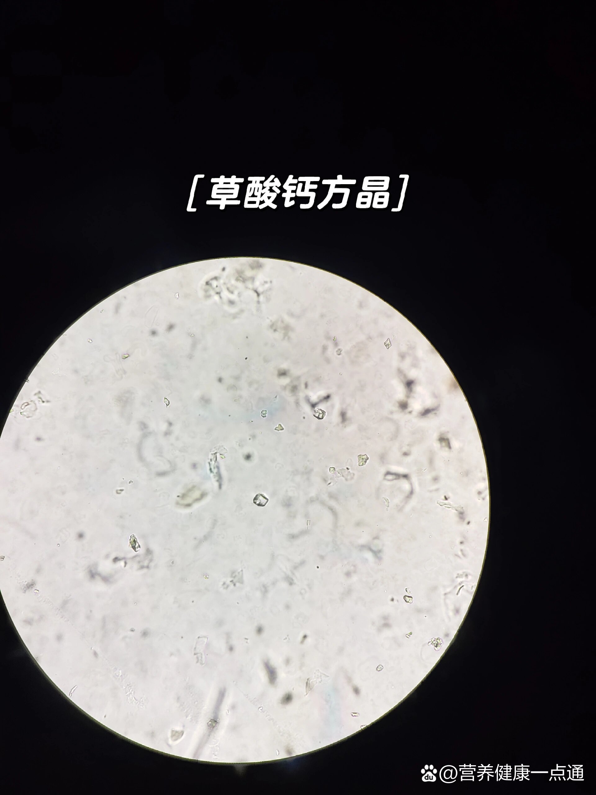 甘草粉末显微图