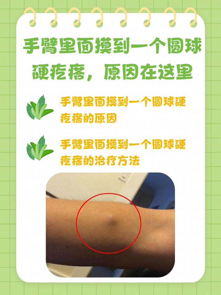 手臂里面摸到一个圆球硬疙瘩,原因在这里