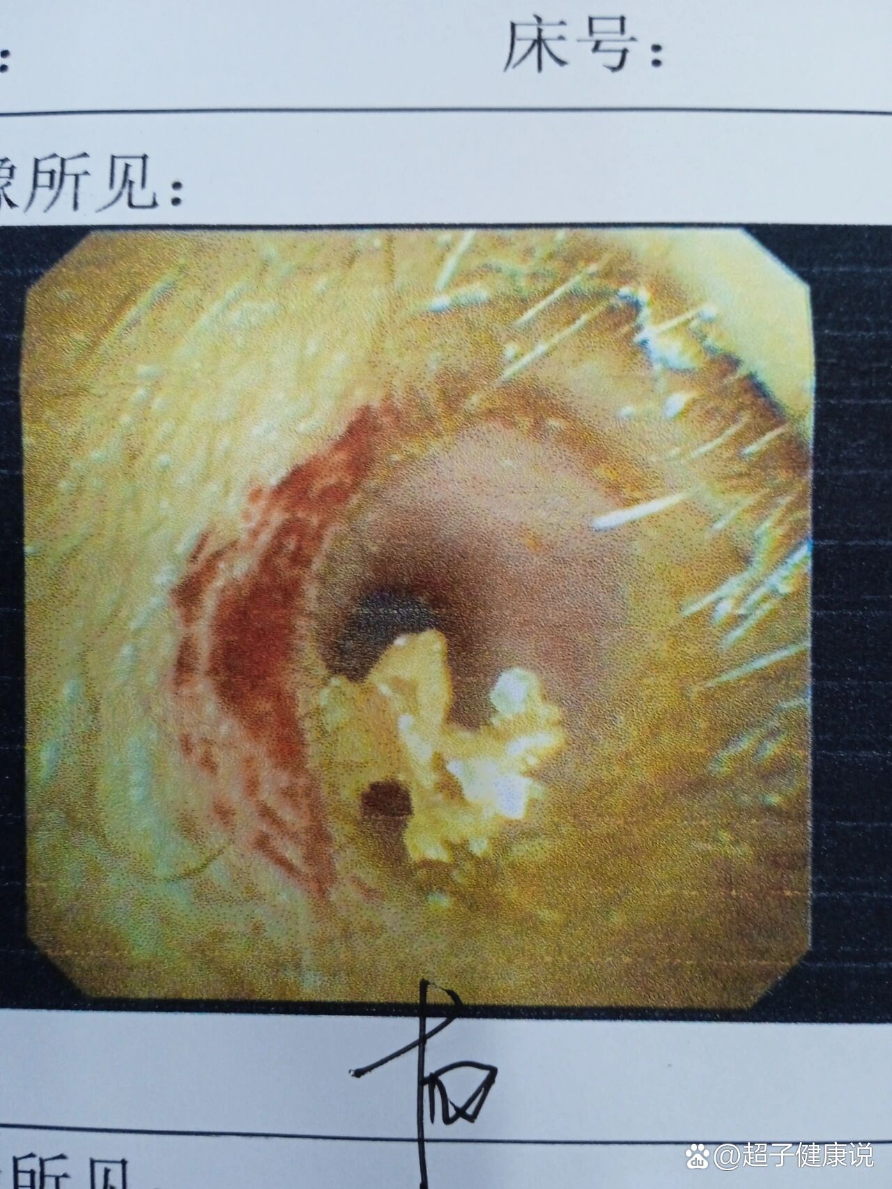 耳朵充血图片图片