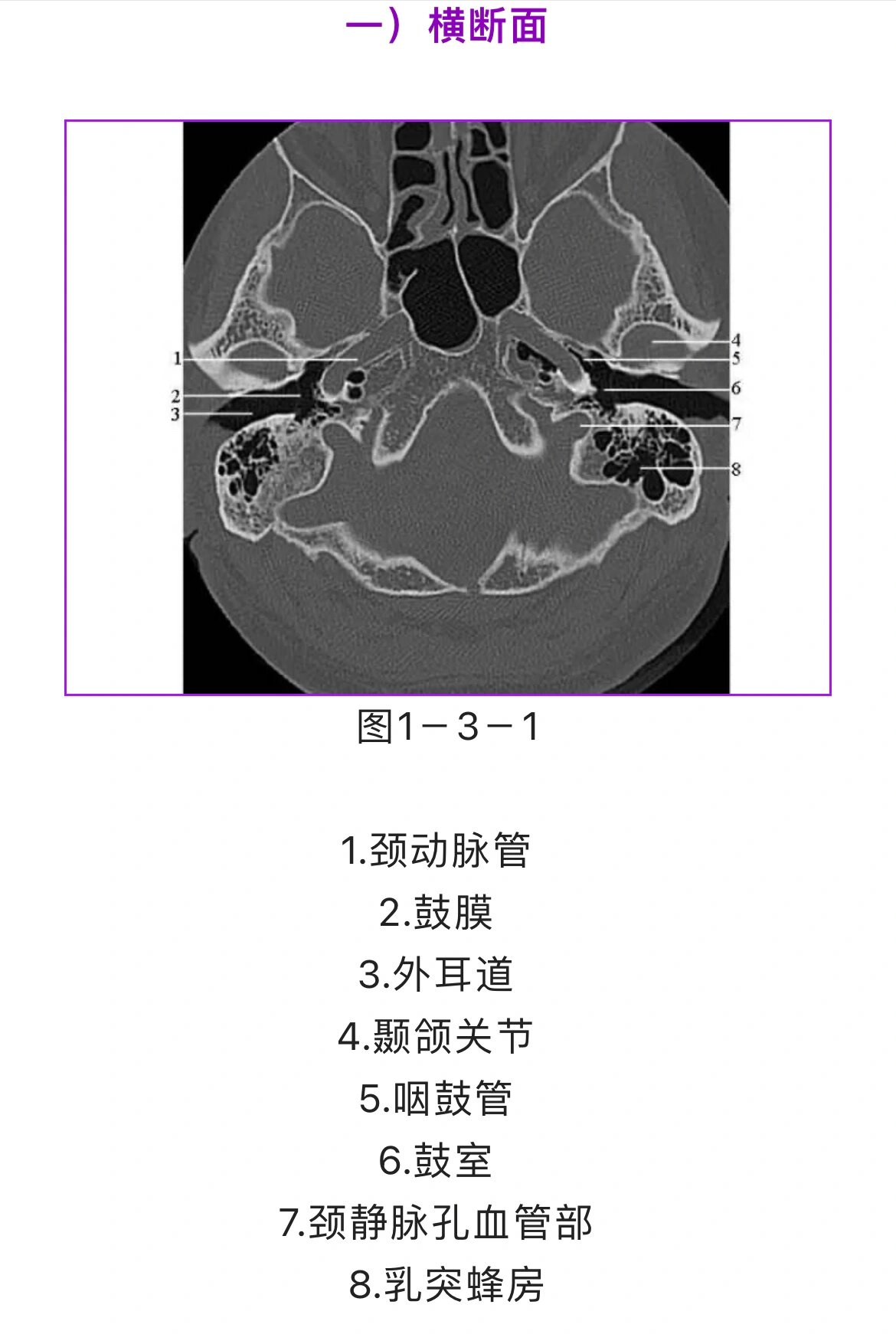 上下颌骨ct平扫解剖图片