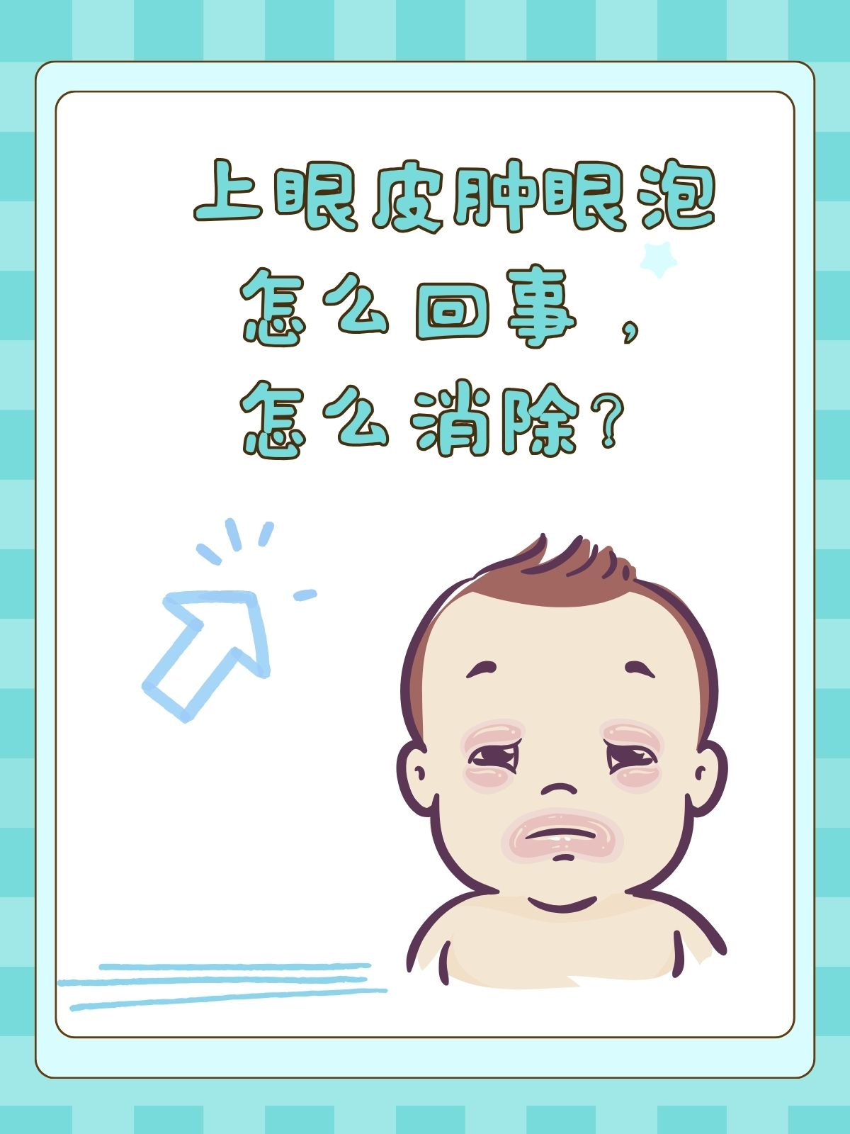 上眼皮肿眼泡怎么回事,怎么消除?