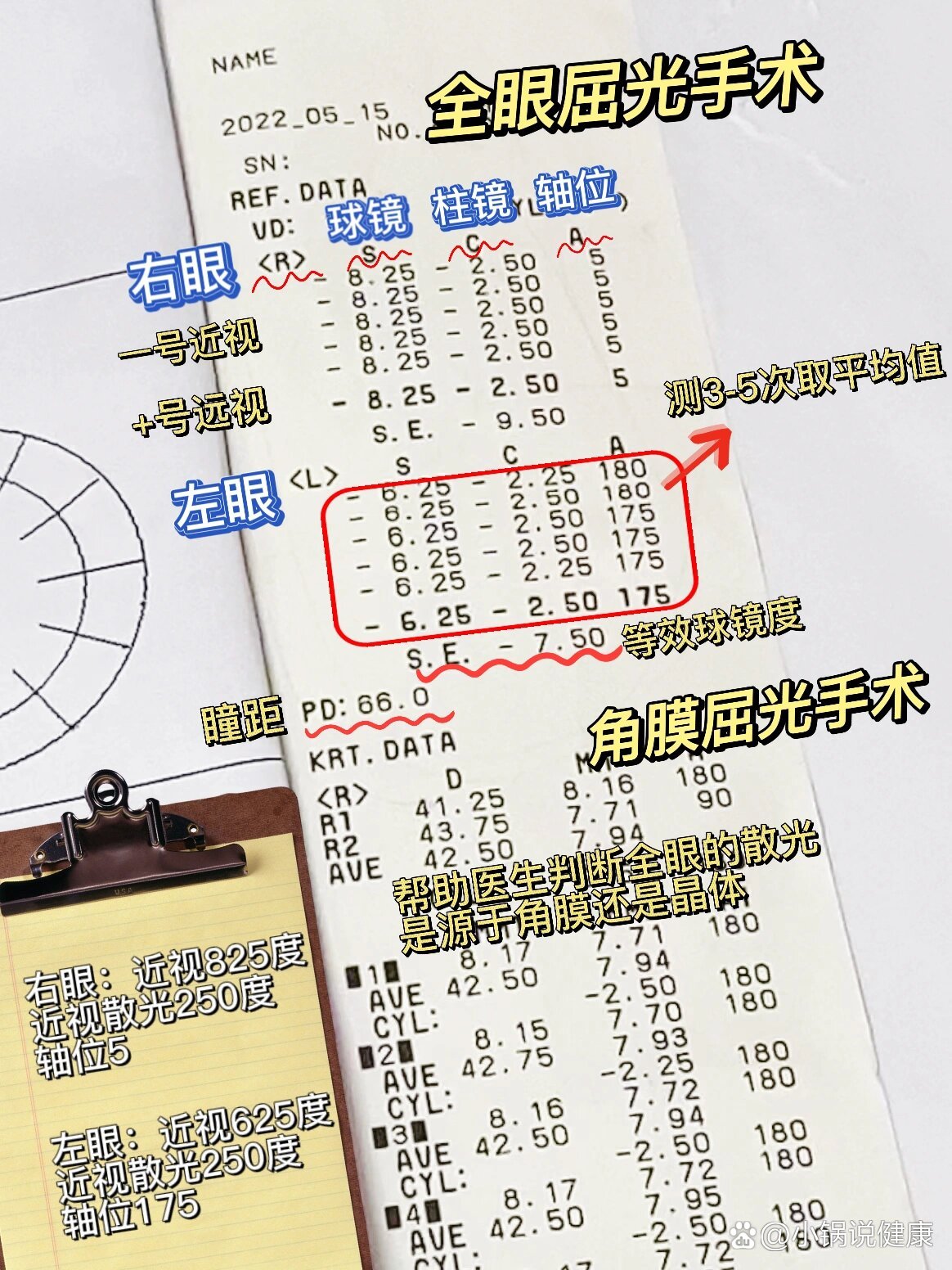 一目了然丨眼科验光单怎么看?