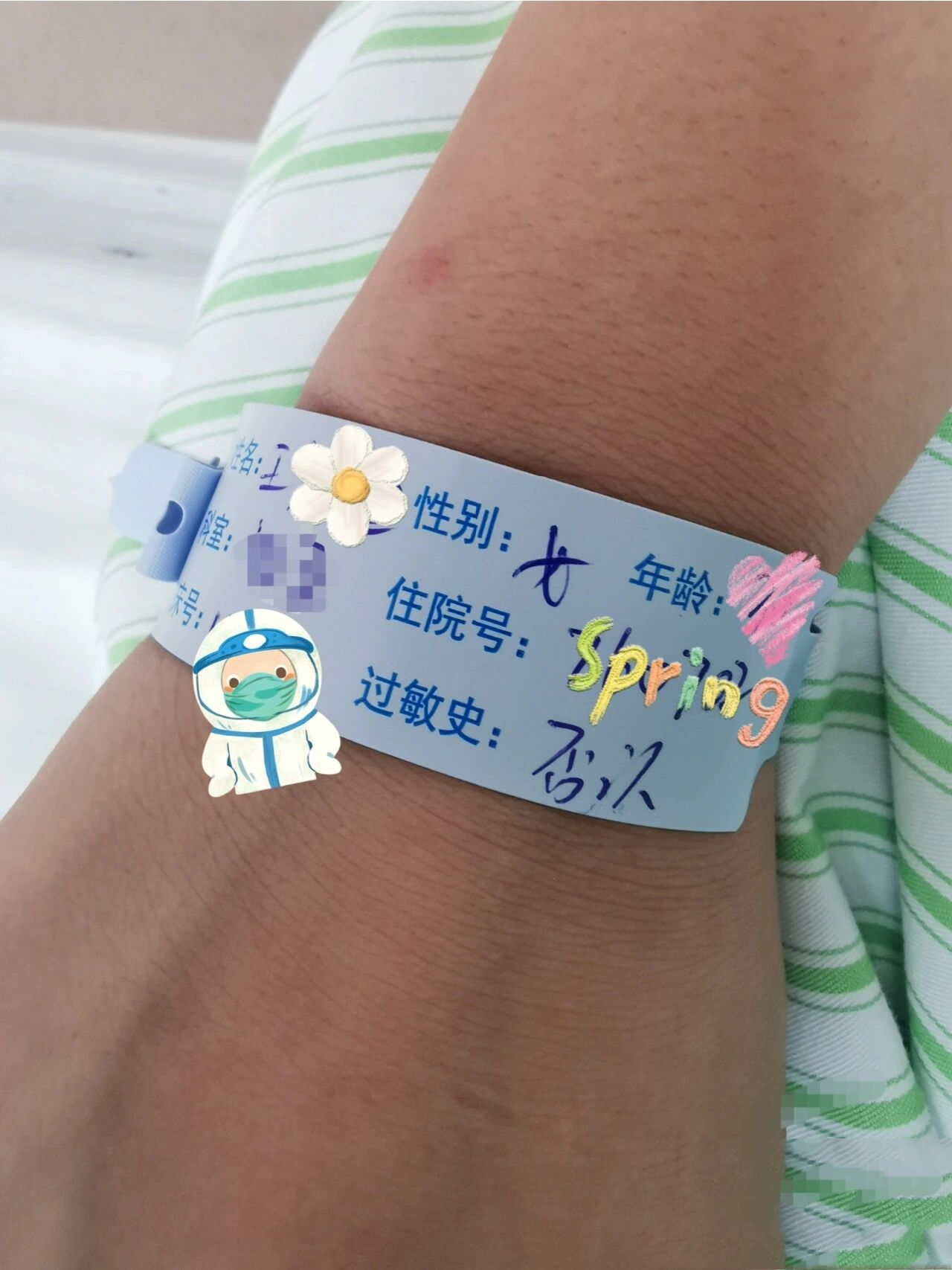巧克力囊肿单孔腹腔镜手术