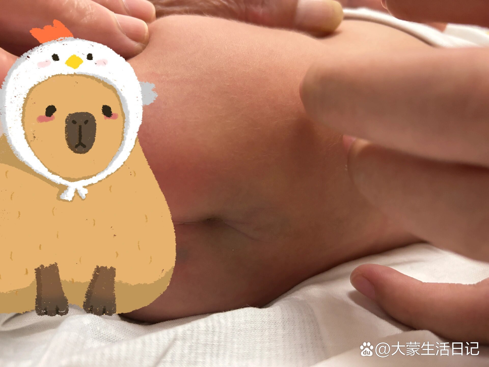 宝宝后屁股这有个坑是咋回事