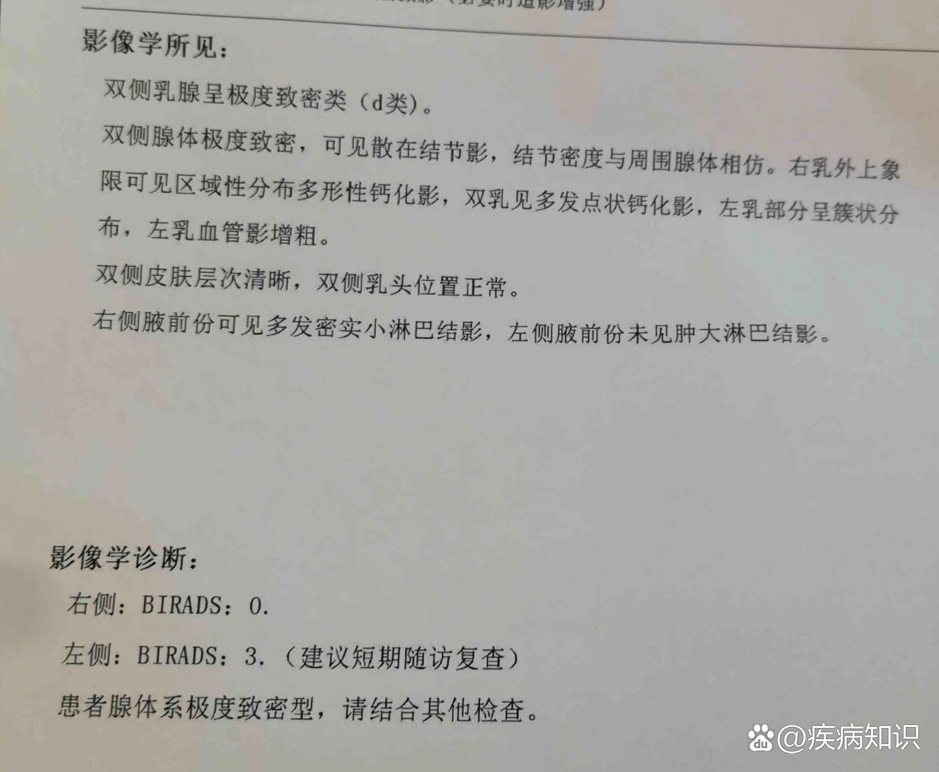 实在不放心,就约了三甲医院乳腺科主任复查,开了钼靶检查,刚拿到报告