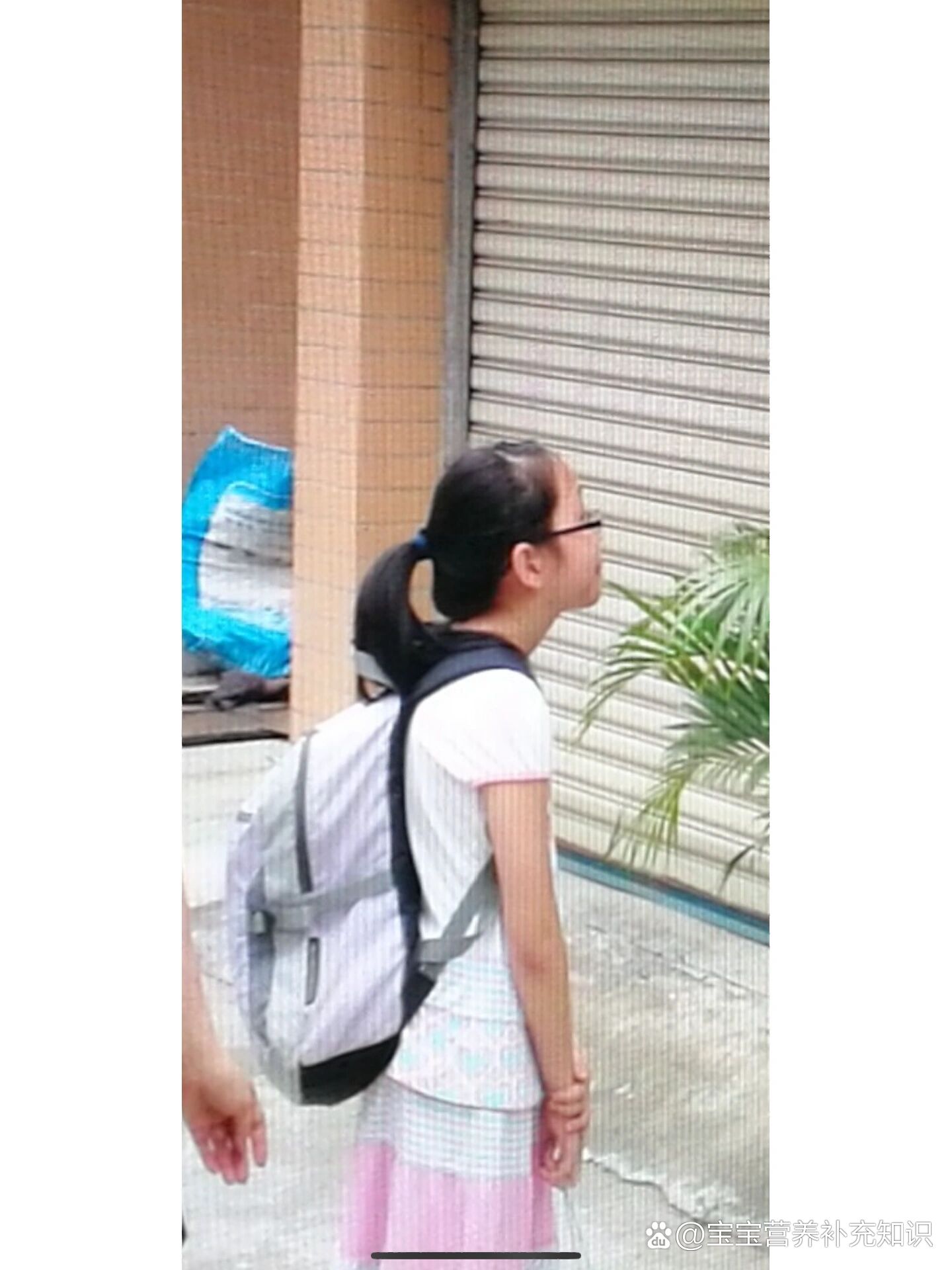 原来小时候驼背就这么严重了看照片才知道,原来小时候驼背和