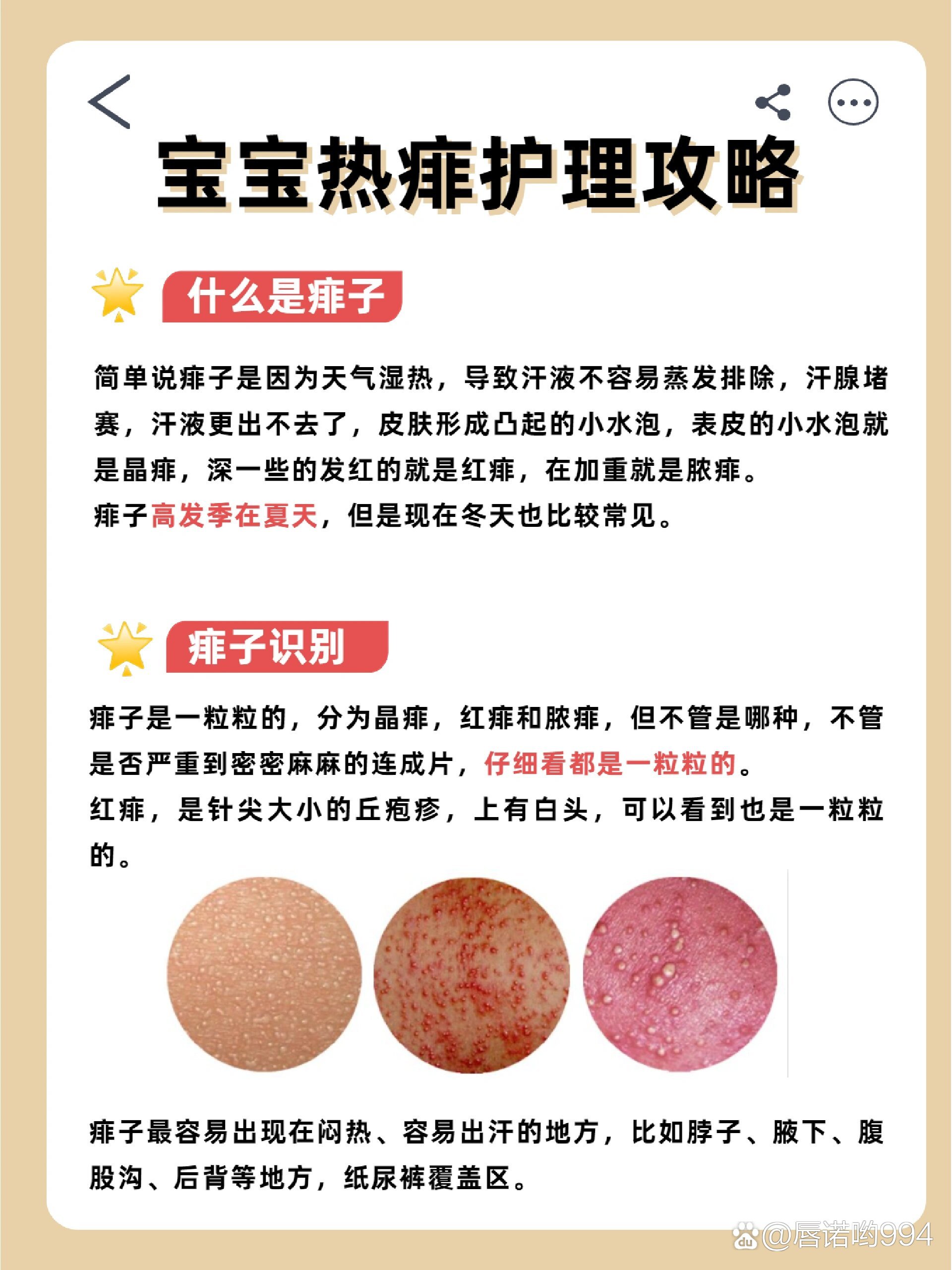 🌞三伏天热痱怎么办?