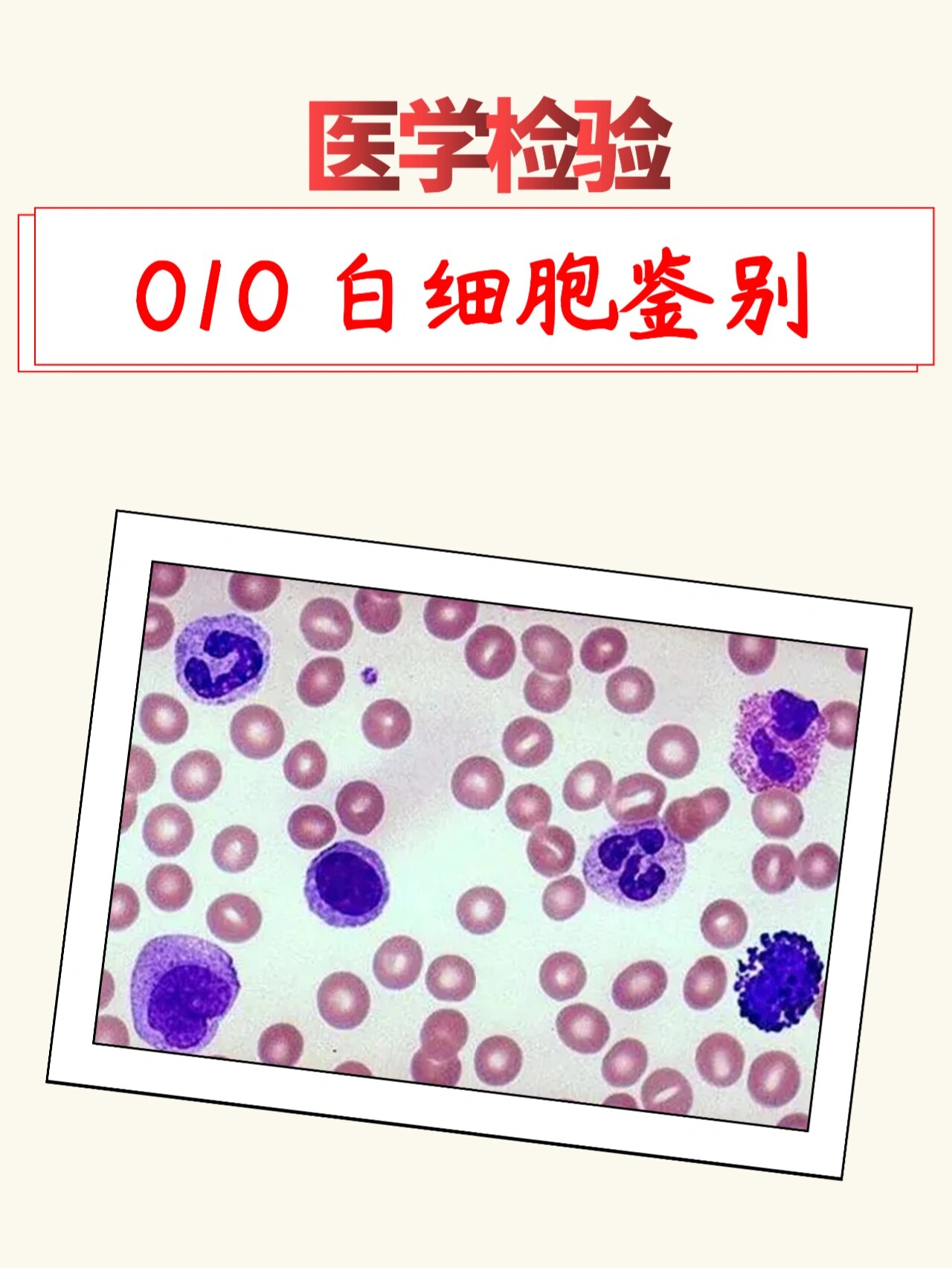 分不清各种白细胞?