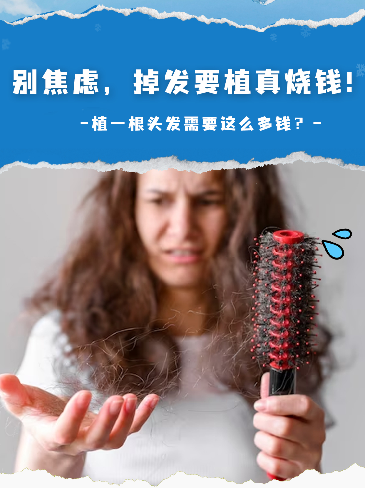 别焦虑,掉发要植真烧钱!植一根头发需要这么多钱?