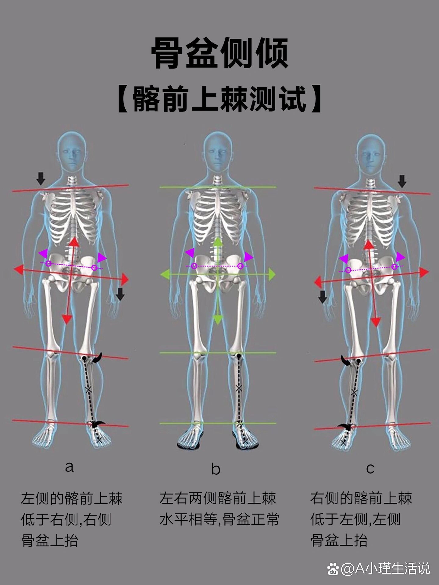 男性骨盆测量正常值图图片