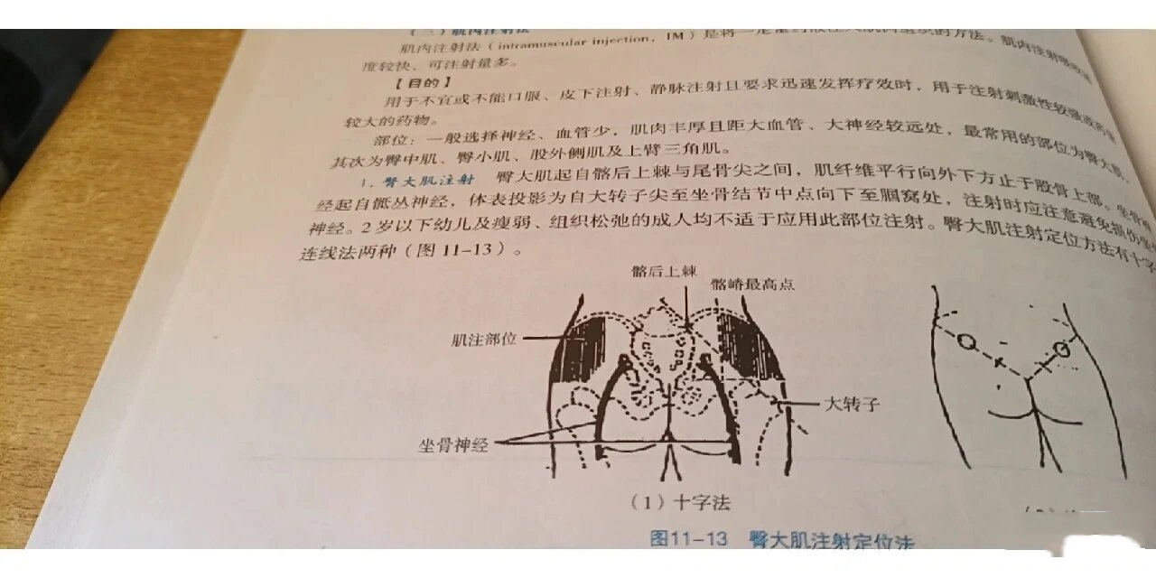 p im十字法连线法 br 臀大肌注射定位法 包括十字法和连线法