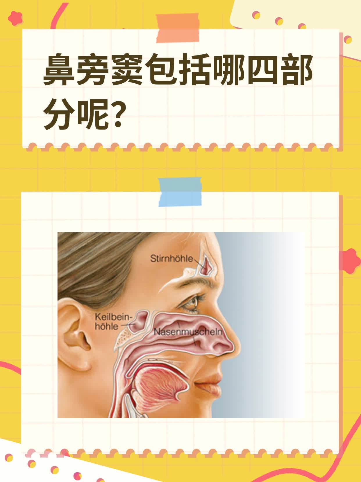 鼻旁窦包括哪四部分呢