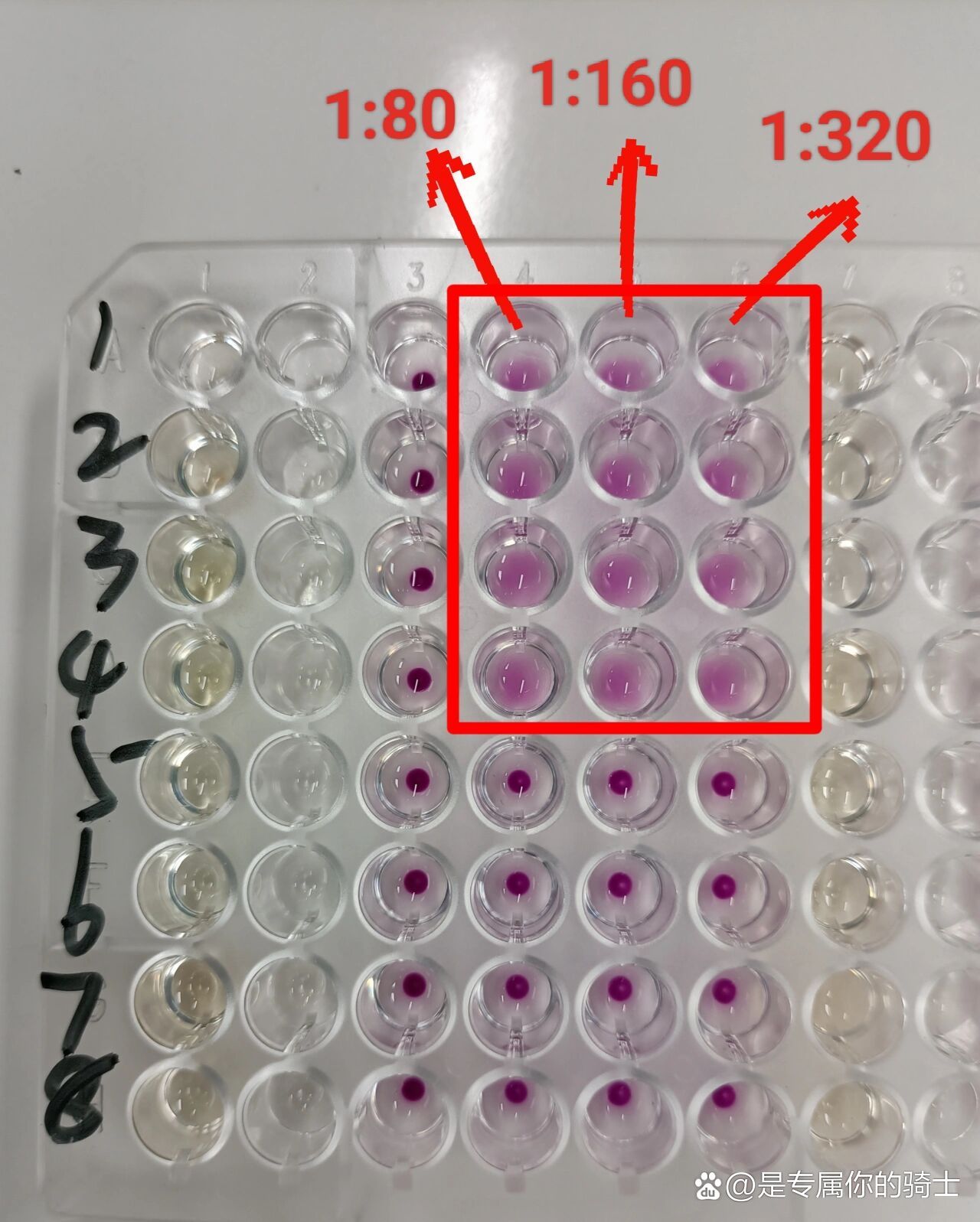 梅毒tppa试验结果该怎么看