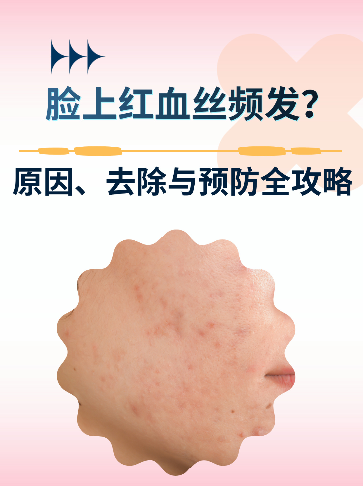 皮肤为什么有红血丝