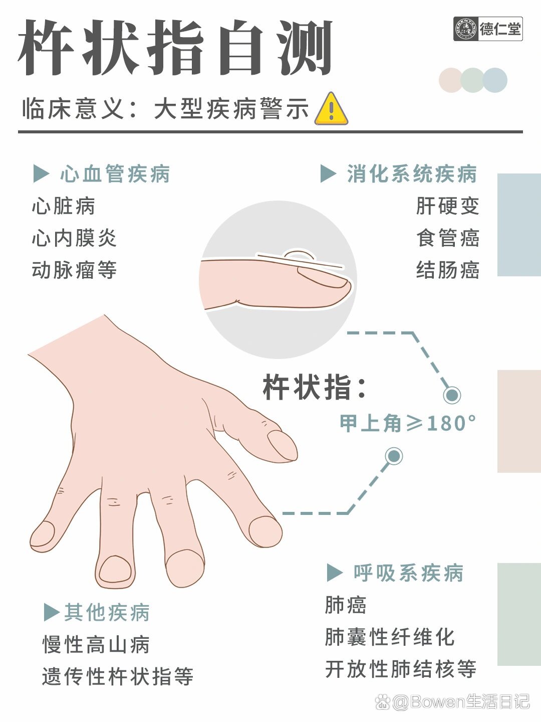 杵状指自测方法图片