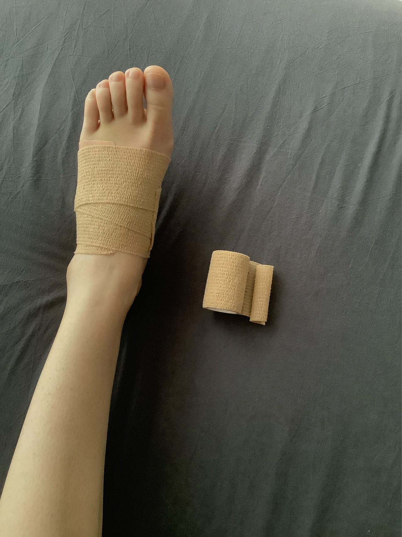 夏天总戴护具又热又不利于血运循环,长时间戴脚容易青紫,弹性绷带包扎