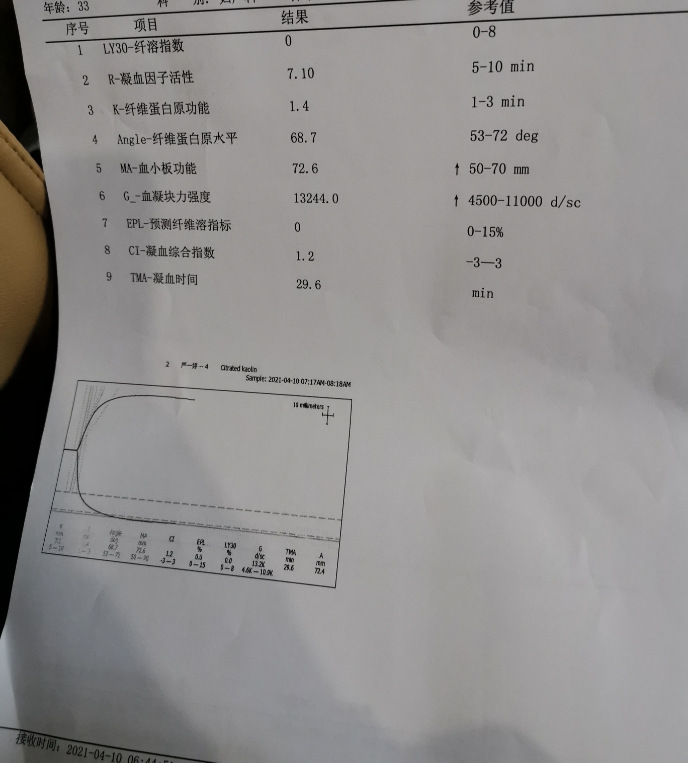 血栓弹力图检验报告图片