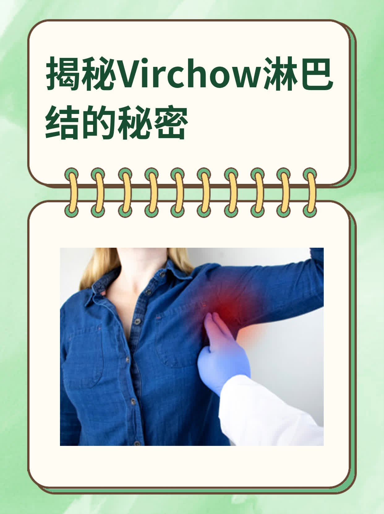 揭秘virchow淋巴结的秘密