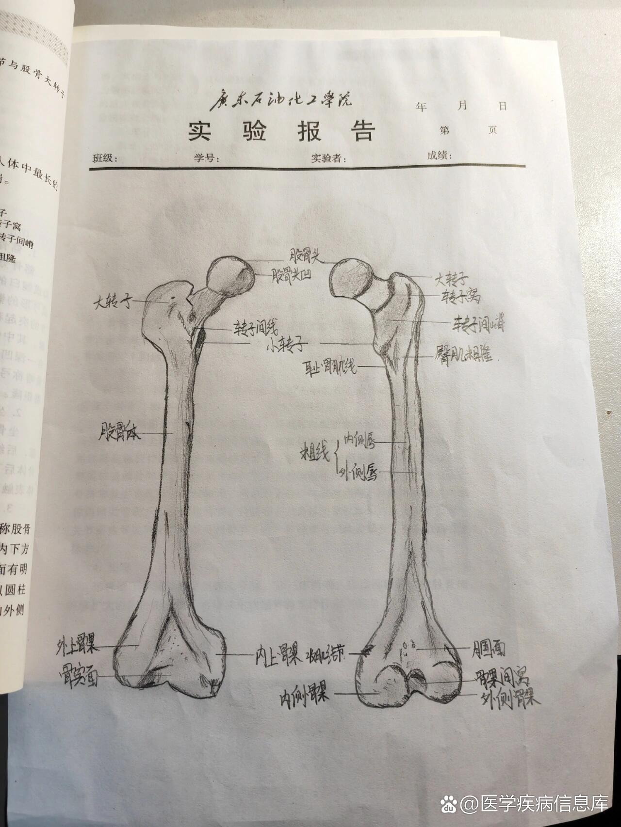 左股骨结构图图片