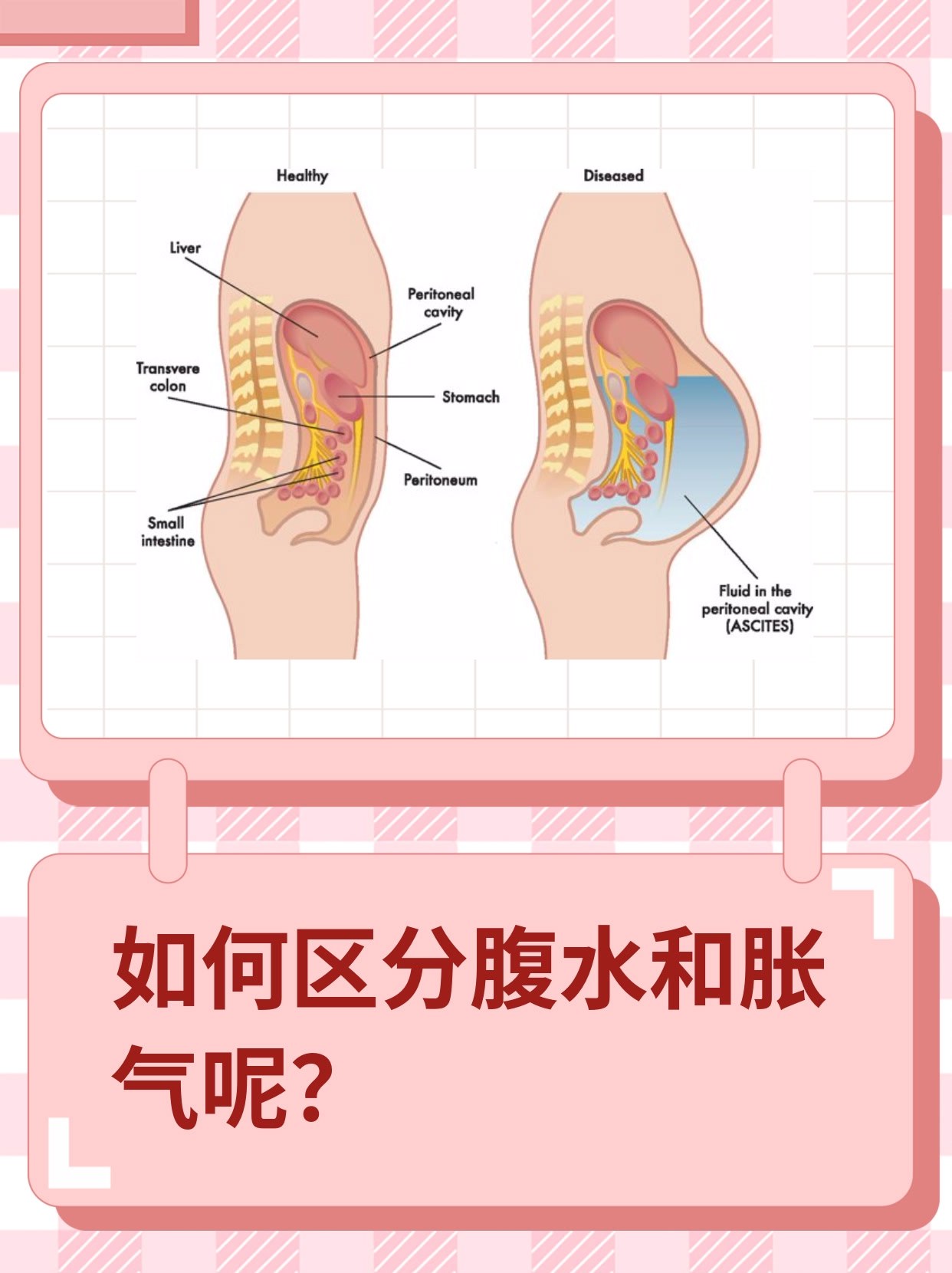 我最近感觉肚子涨涨的