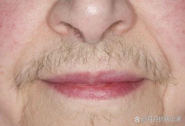 女性6个表现,警惕不孕症