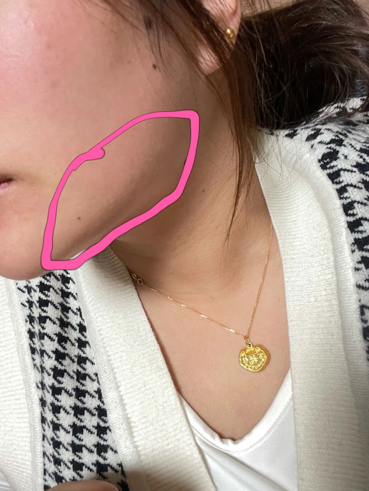 脸颊两侧下颚线附近都痒头发碰到都痒