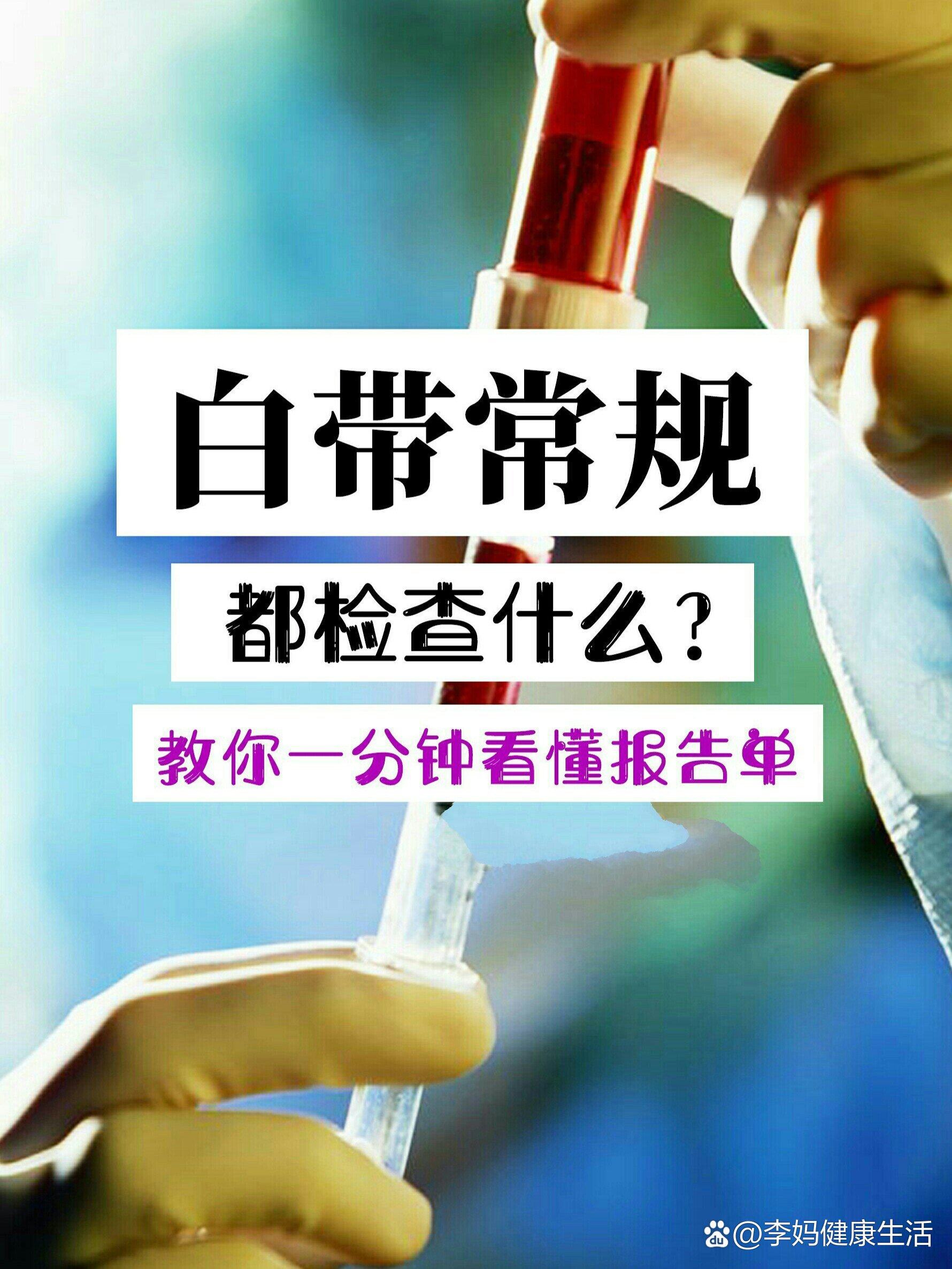 72白带常规检查什么?