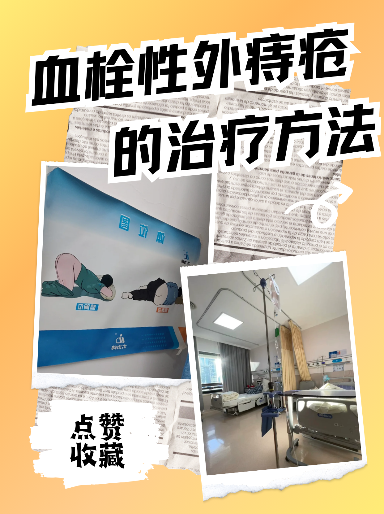 关于血栓性外痔疮,你知道多少?