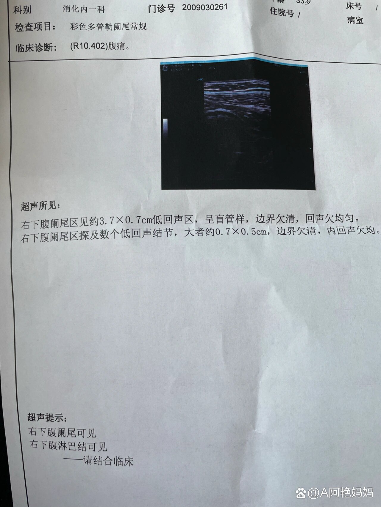 去医院看胃诊断出阑尾炎?
