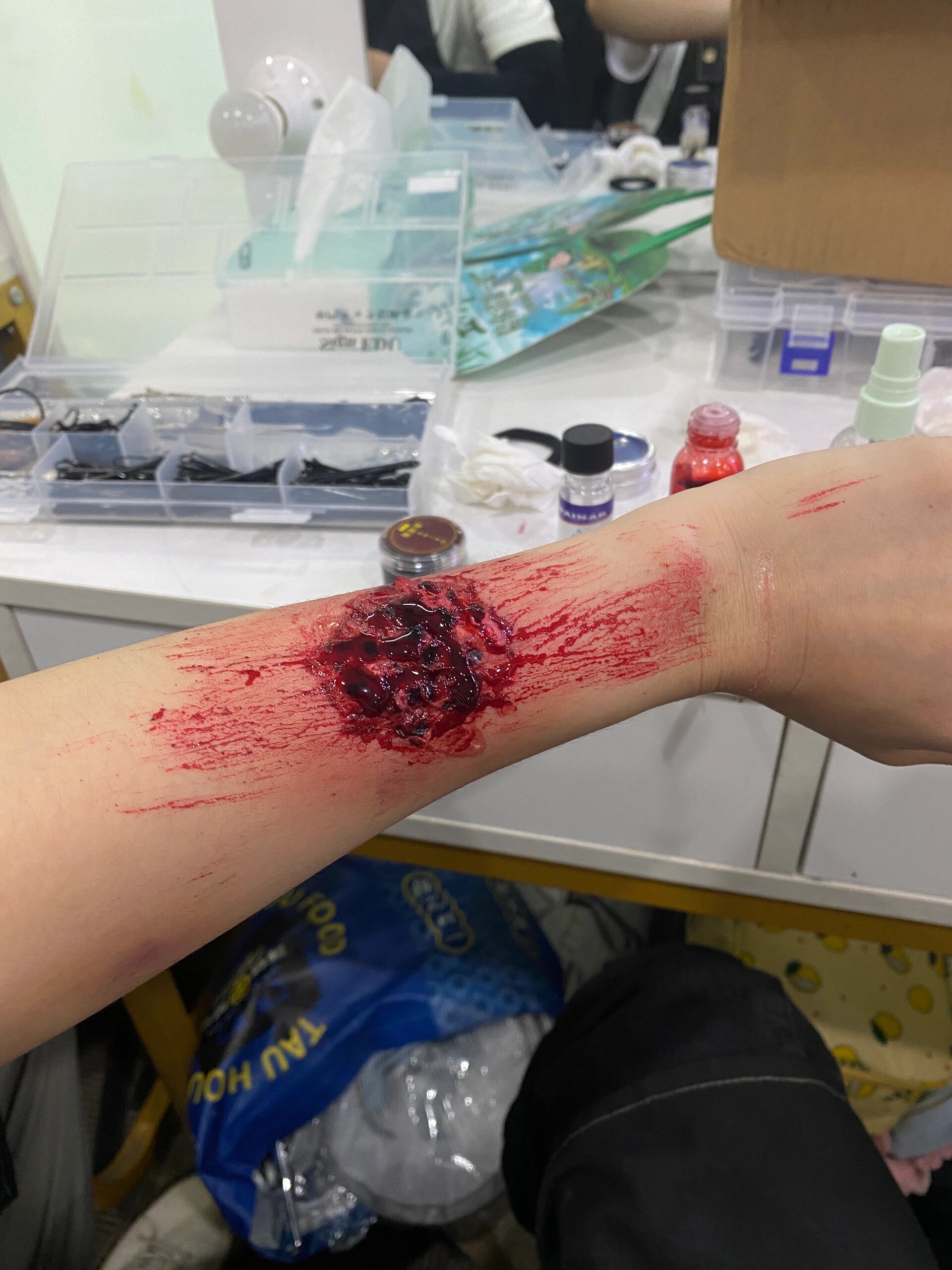 猜猜这是什么伤口