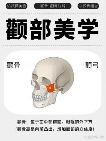 高颧骨VS颧弓外扩 傻傻分不清楚🤯