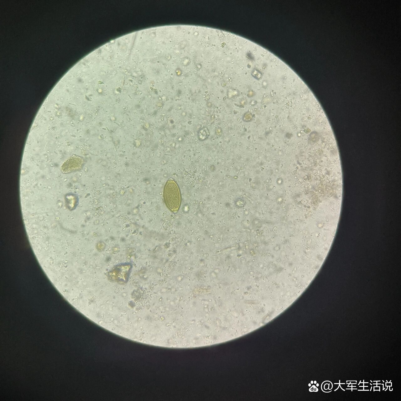 饶虫卵显微镜下图片图片