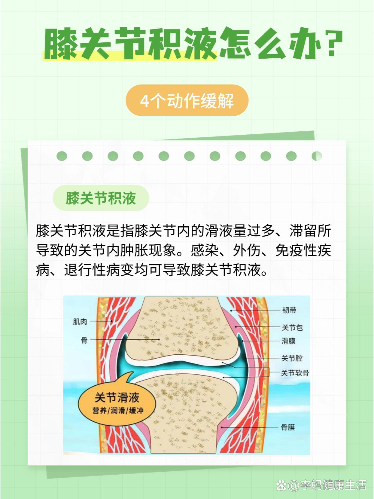 膝关节积液怎么办❓4招缓解 保守治疗�