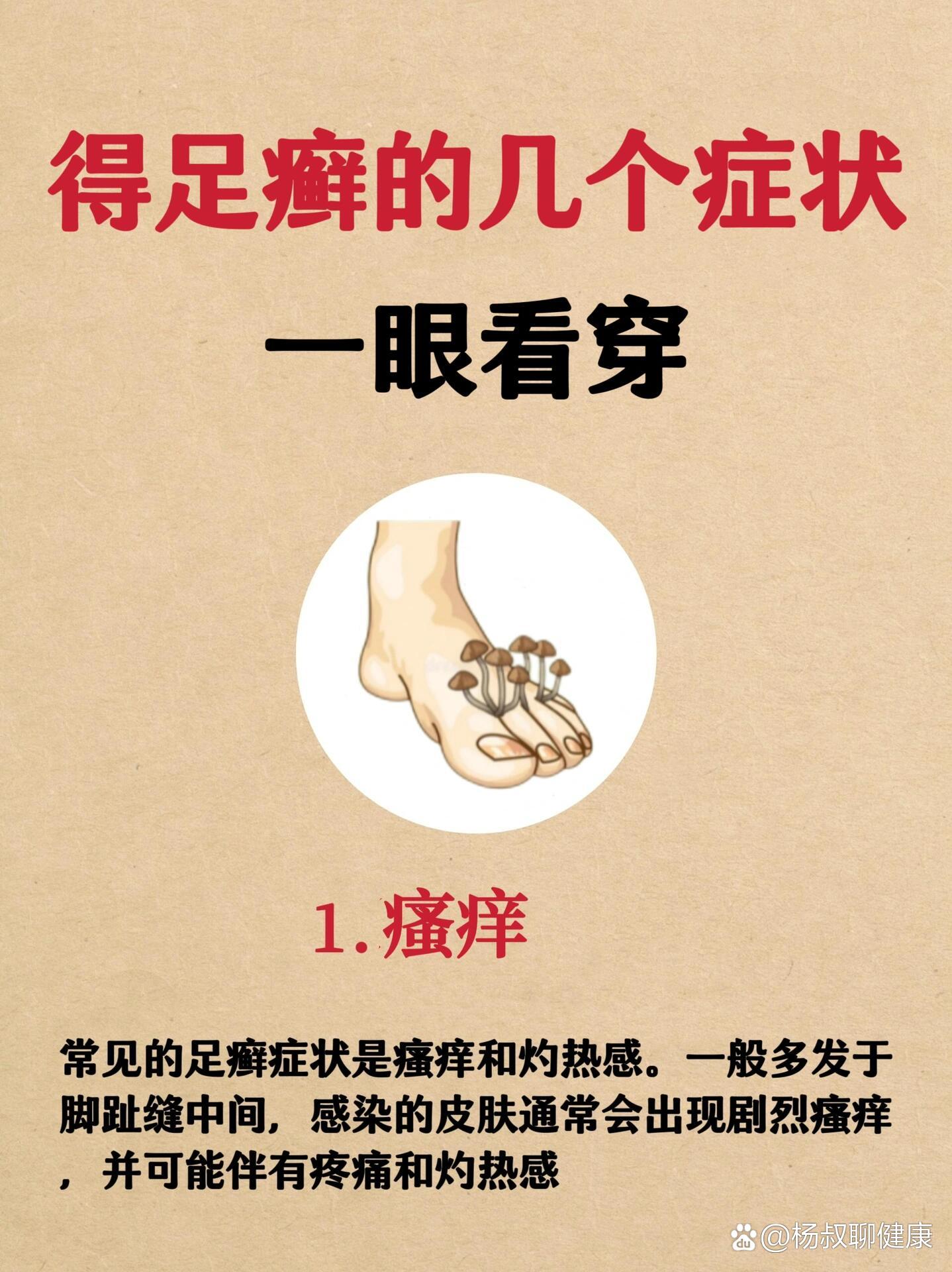 痔疮为什么会痒为什么在线