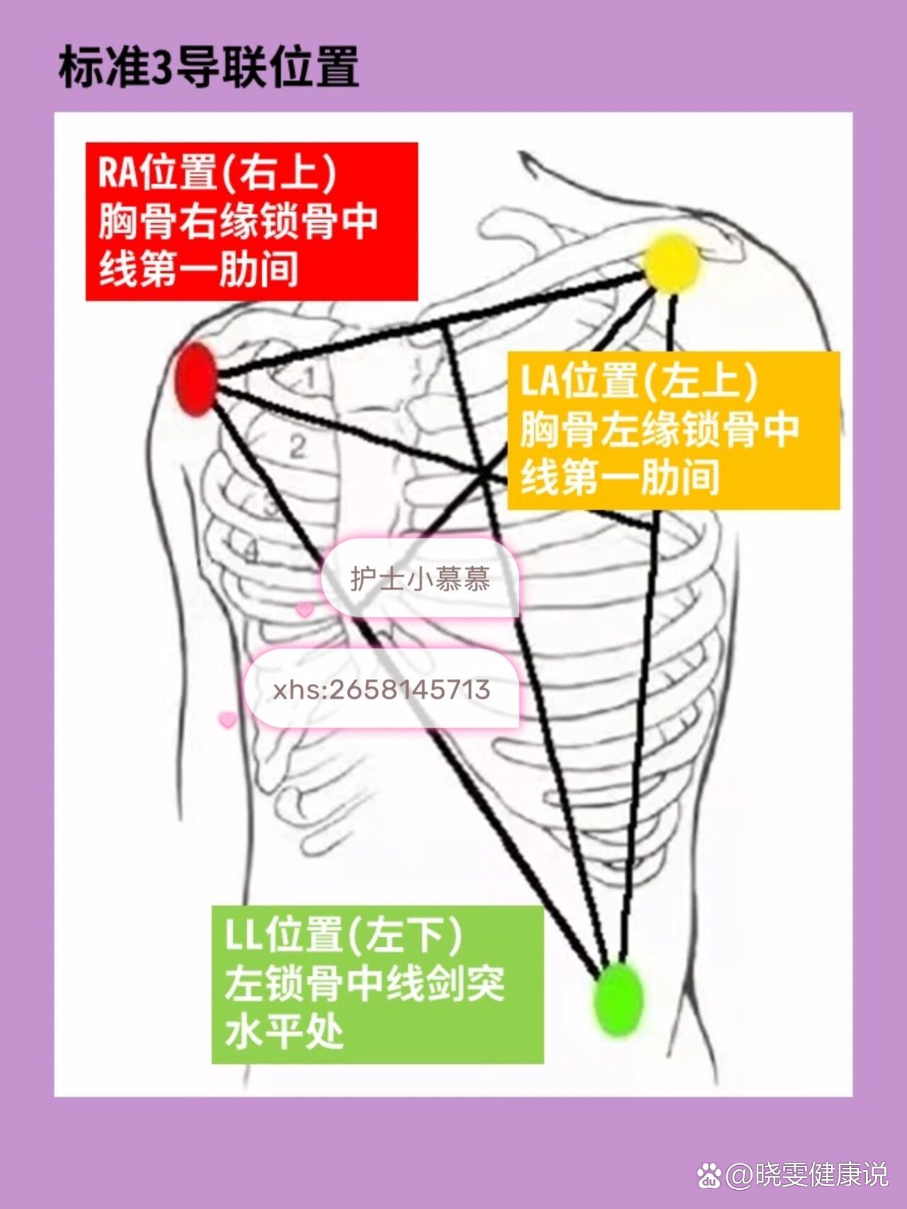 护士