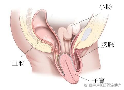 治疗子宫脱垂最好的办法是什么?