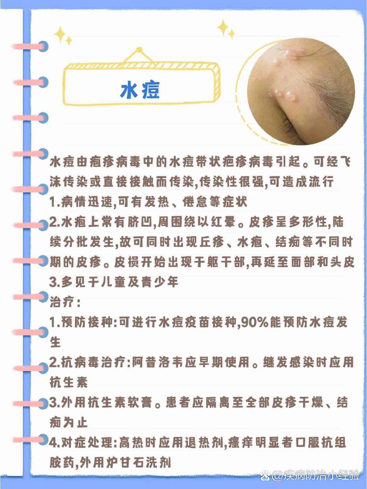 得了水痘怎么办?