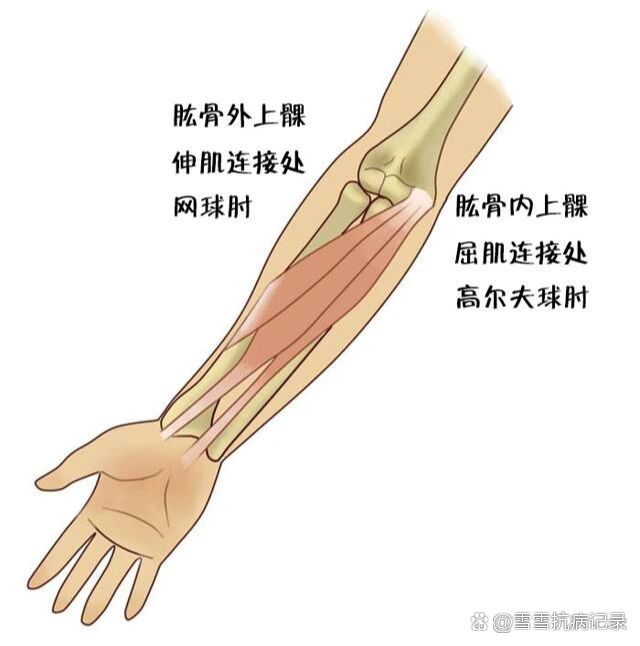 胳膊在哪个位置图图片