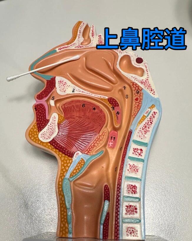 总鼻道图片