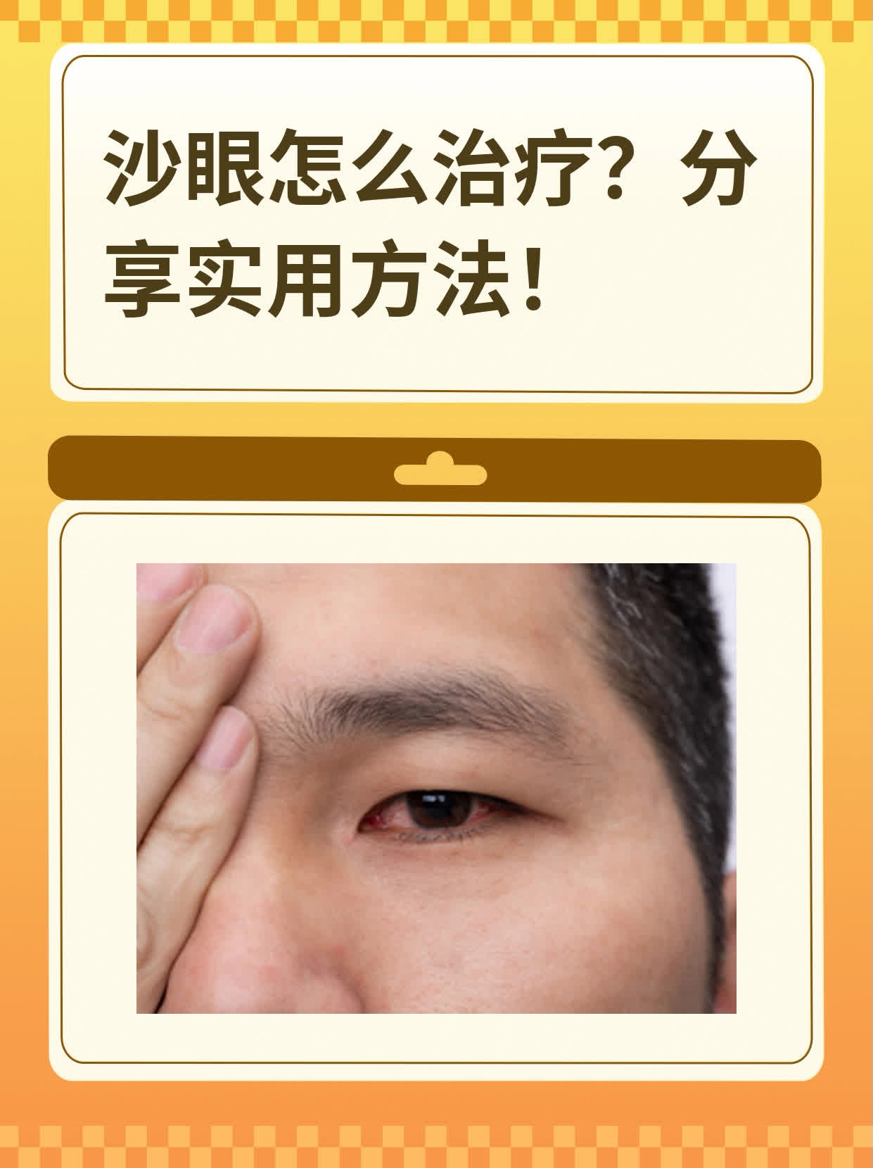 沙眼怎么治疗?分享实用方法