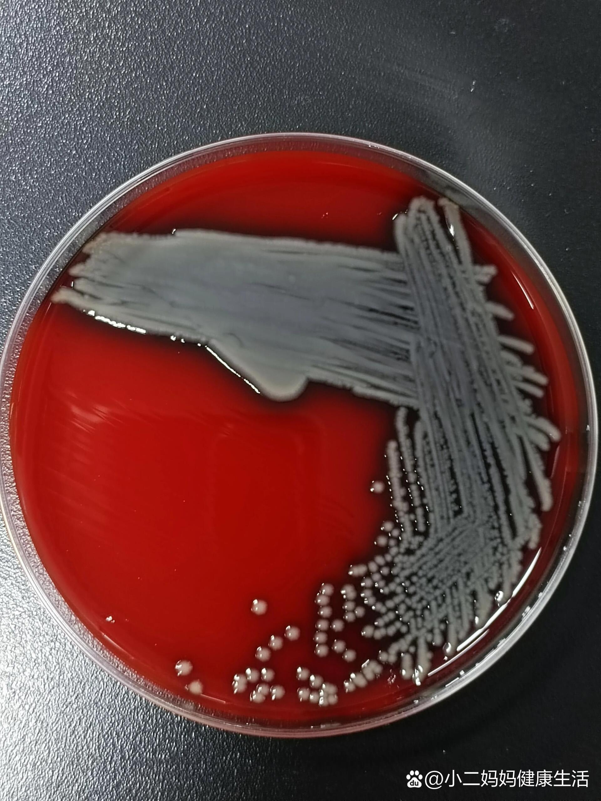 颗颗分明的杀鲑气单胞菌
