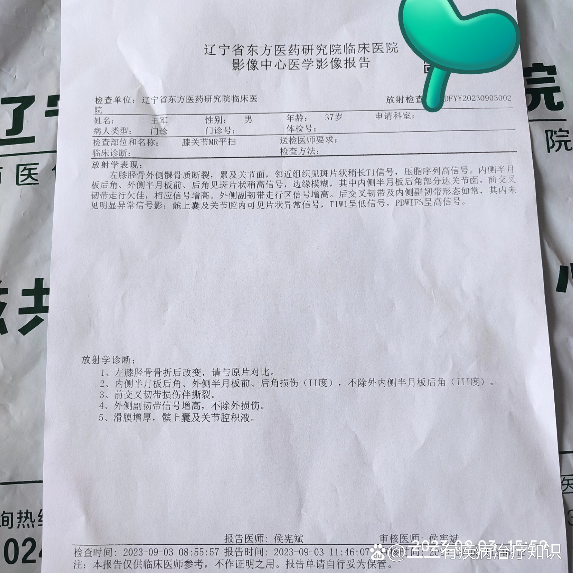 去医院97拍片,大夫竟然看不出来结果,ct检查都写了,左胫骨平台骨折